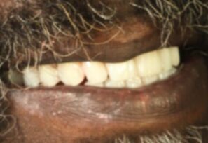 After - Alexandra Dental