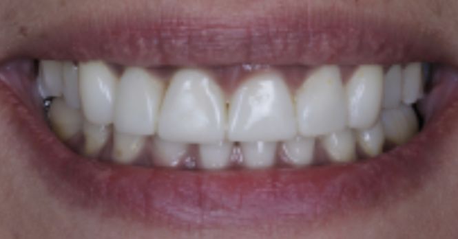 After - Alexandra Dental