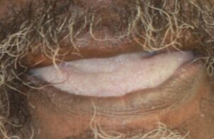 Before - Alexandra Dental