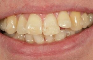 Before - Alexandra Dental