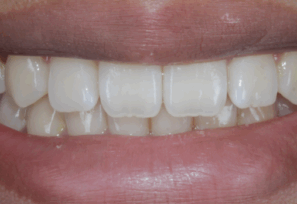 After close up mouth