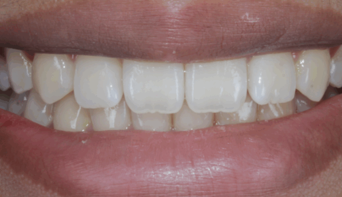 After close up mouth
