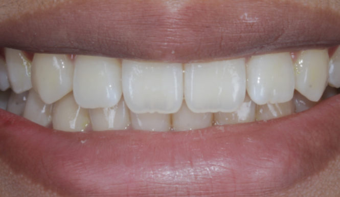 After close up mouth