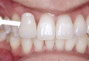 After - Alexandra Dental