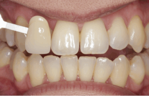Before - Alexandra Dental