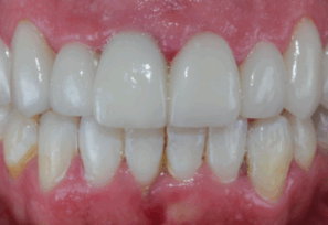 After - Alexandra Dental