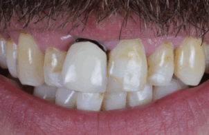 Before - Alexandra Dental