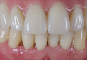 After - Alexandra Dental