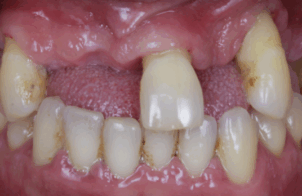 Before - Alexandra Dental