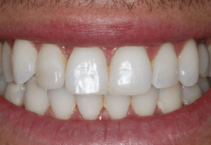 After - Alexandra Dental