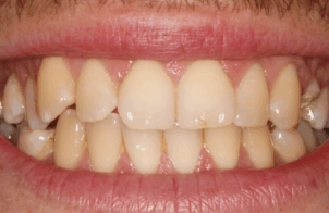 Before - Alexandra Dental