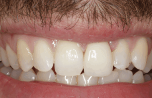 Before - Alexandra Dental