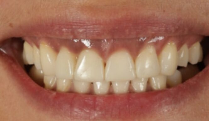 After - Alexandra Dental