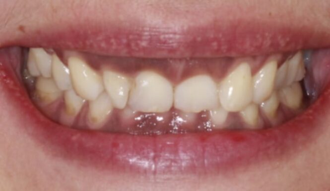 Before - Alexandra Dental