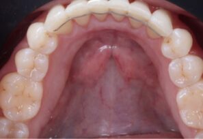 After - Alexandra Dental