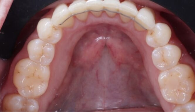 After - Alexandra Dental