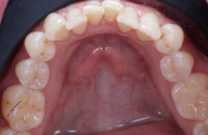 Before - Alexandra Dental