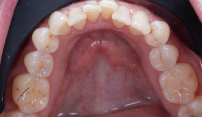 Before - Alexandra Dental