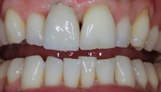 After - Alexandra Dental