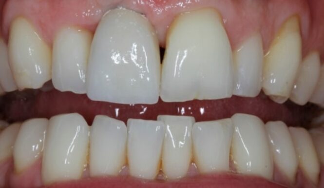 After - Alexandra Dental