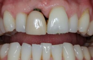 Before - Alexandra Dental