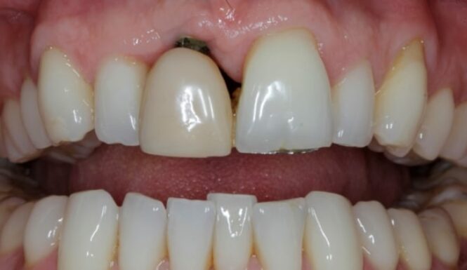 Before - Alexandra Dental