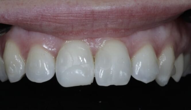Before - Alexandra Dental