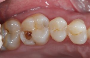 Before - Alexandra Dental