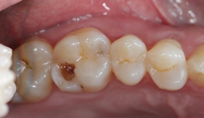 Before - Alexandra Dental