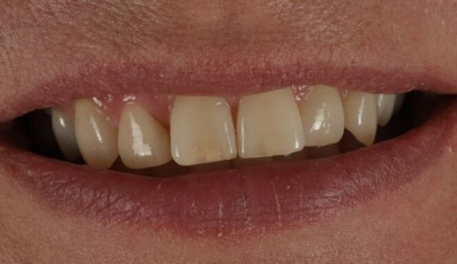 Before - Alexandra Dental